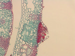 MISSING THUMBNAIL